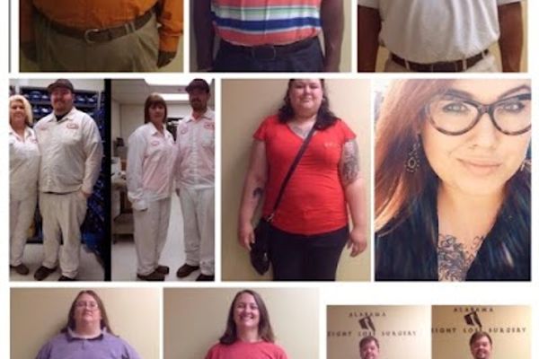 Alabama Weight Loss Surgery in Birmingham, AL