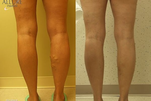 Allure Medical in Warren, MI