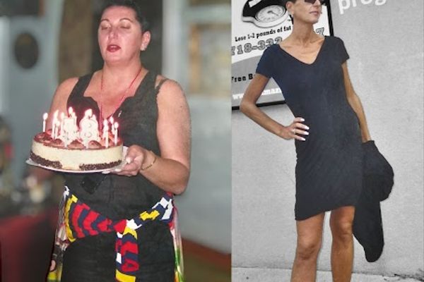 Amazing Weight Loss in Brooklyn, NY