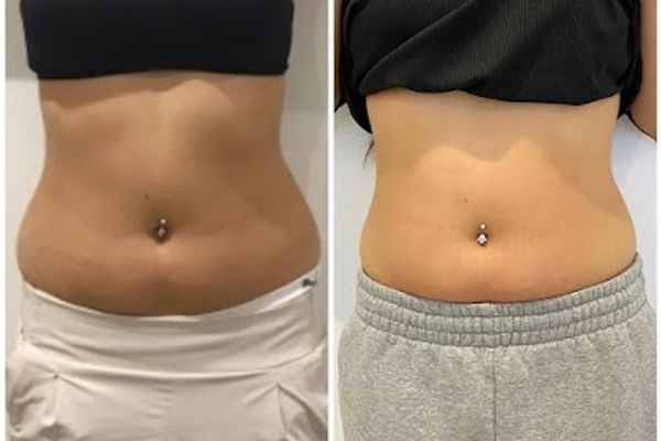 InShapeMD Ballantyne in Charlotte, NC