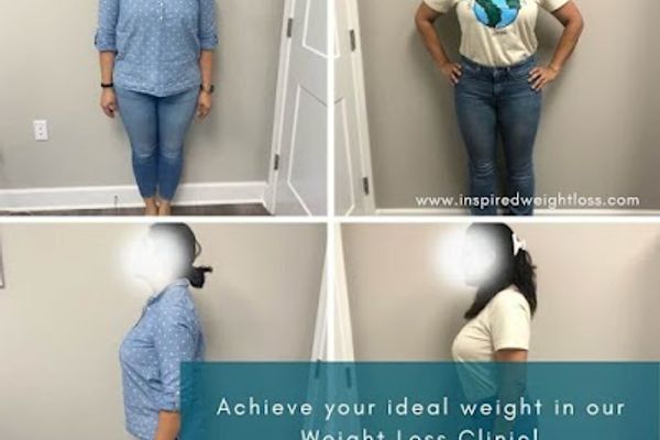Inspire Weight Loss in Orlando, FL