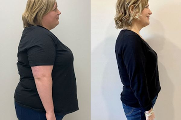 Merit Weight Loss in Leawood, KS