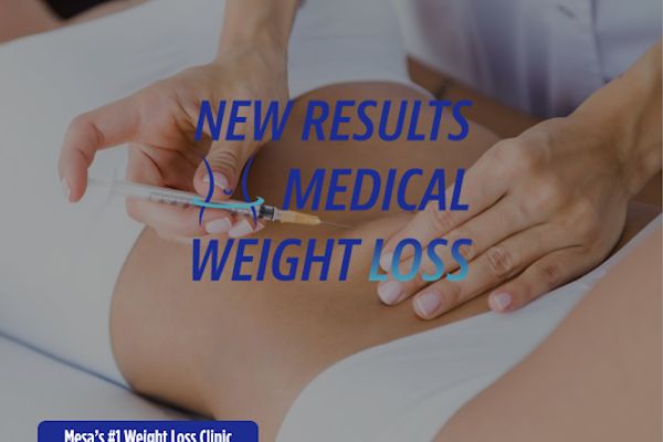 New Results Medical Weight Loss in Mesa, AZ
