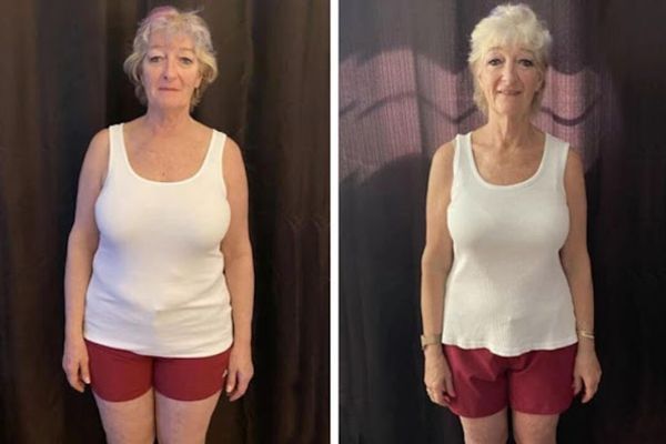 Sioux Falls Secret for Weight Loss in Sioux Falls, SD