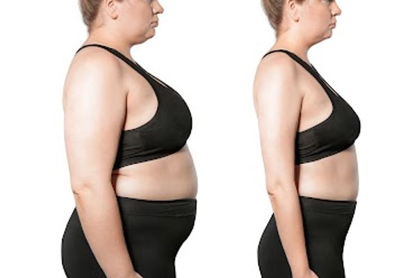 Slimmetry Medical Center in Metairie, LA