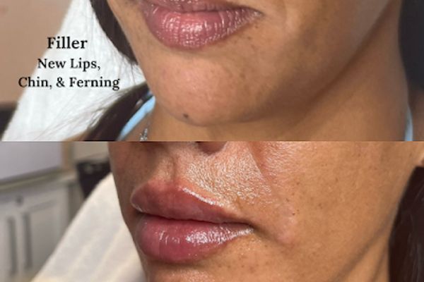 The Aura Clinic in Brentwood, TN