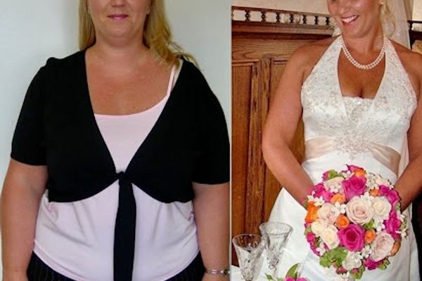 The Weight Loss Surgery Center of Los Angeles in Glendale, CA