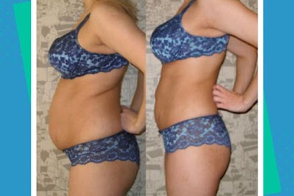 True Weight Loss Clinic in Austin, TX