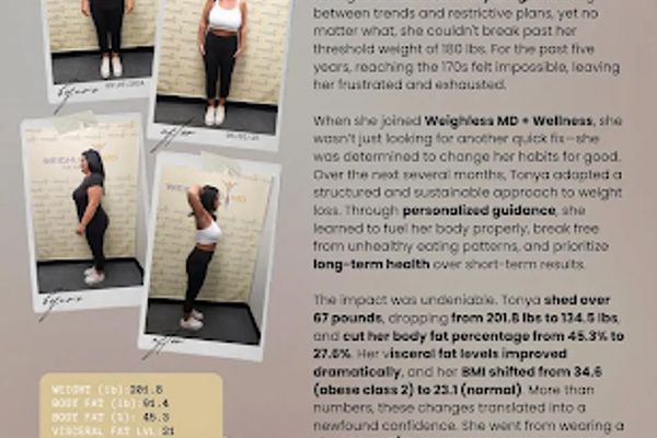 Weighless MD in St. Louis, MO