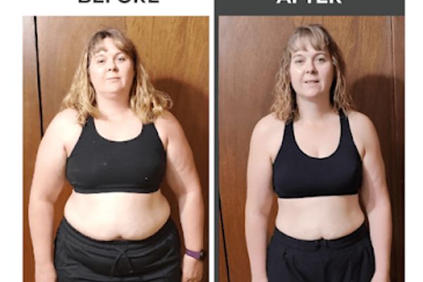 Weight Loss Center of San Diego (SD FAT LOSS) in San Diego, CA